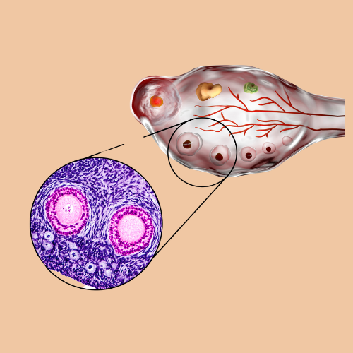 egg-pickup-and-oocyte-retrival