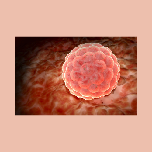 frozen-embryo-transfer