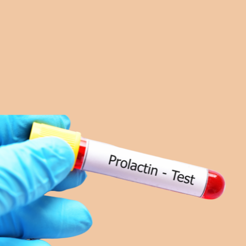 prolactin